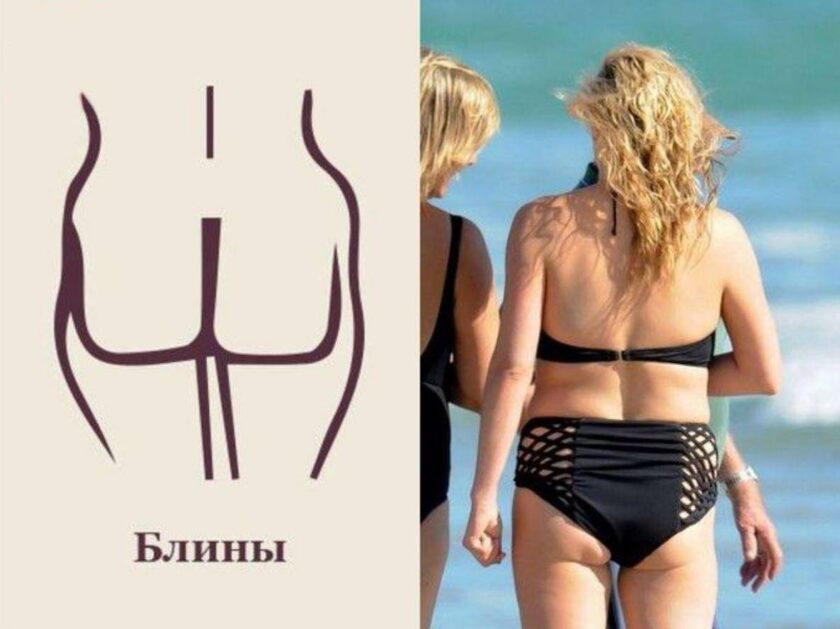 Типы Поп У Девушек Фото Типы Поп У Девушек Фото