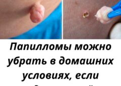 Папилломы можно убрать в домашних условиях, если сделать всё правильно…